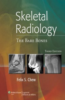 Skeletal radiology : the bare bones