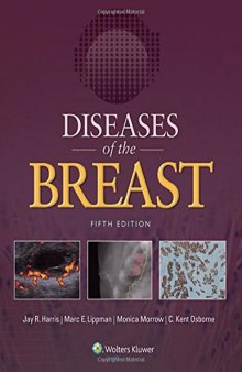 Diseases of the breast