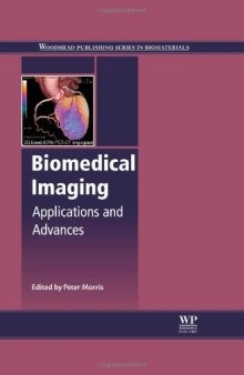 Biomedical Imaging. Applications and Advances