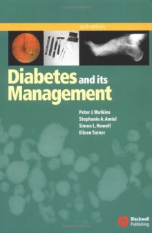 Diabetes and Its Management 6th Edition  