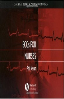 ECGs for Nurses (Essential Clinical Skills for Nurses)