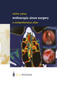 Endoscopic Sinus Surgery: A Comprehensive Atlas