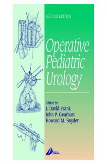 Operative Pediatric Urology