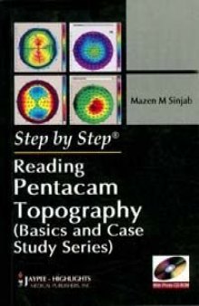 Reading Pentacam Topography (Step By Step: Basics and Case Study Series)