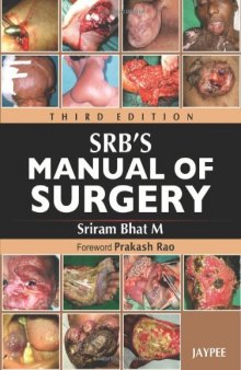 SRB'S Manual of Surgery, 3/E