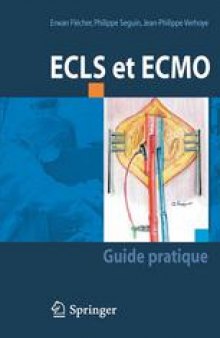 ECLS et ECMO: Guide pratique