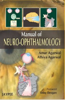 Manual of Neuro Ophthalmogy  