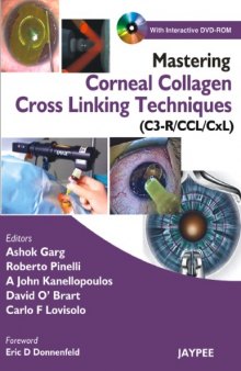 Mastering Corneal Collagen Cross Linking Techniques