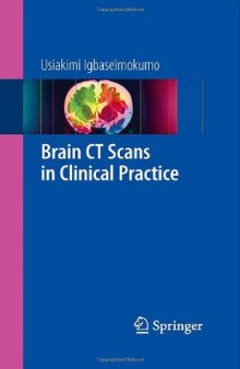 Brain CT Scans in Clinical Practice  