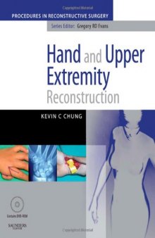 Hand And Upper Extremity Reconstruction  