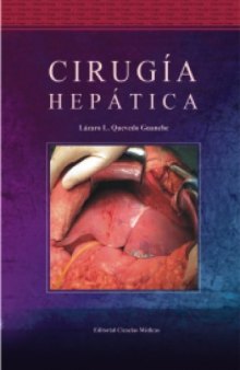 Cirugia Hepatica  