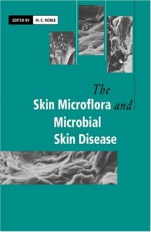 The Skin Microflora and Microbial Skin Disease