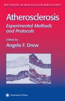 Atherosclerosis: Experimental Methods and Protocols