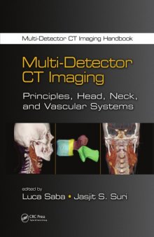 Multi-Detector CT Imaging: Principles, Head, Neck, and Vascular Systems