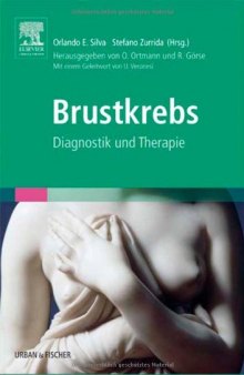 Brustkrebs. Diagnostik und Therapie