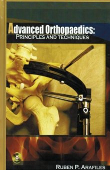 Advanced Orthopaedics: Principles and Techniques