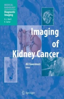 Imaging of Kidney Cancer (Medical Radiology   Diagnostic Imaging)