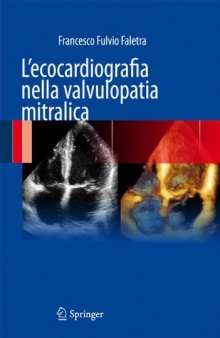 L’ecocardiografia nella valvulopatia mitralica