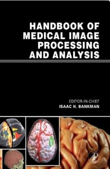 Handbook of medical image processing and analysis