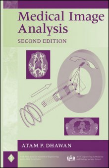 Medical Image Analysis, Second Edition