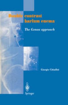 Double contrast barium enema: The Genoa approach