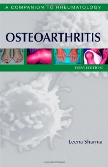 Osteoarthritis: A Companion to Rheumatology  
