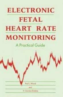 Electronic Fetal Heart Rate Monitoring: A Practical Guide