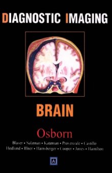 Diagnostic Imaging  Brain