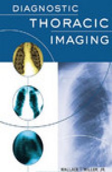 Diagnostic Thoracic Imaging