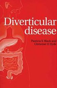 Diverticular disease