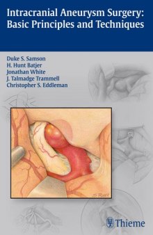 Intracranial Aneurysm Surgery: Basic Principles and Techniques