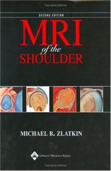 MRI of the Shoulder, 2nd edition