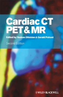 Cardiac CT, PET and MR, Second Edition  