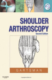 Shoulder Arthroscopy, 2nd Edition