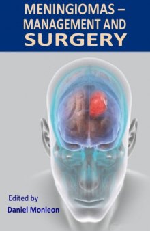 Meningiomas – Management and Surgery