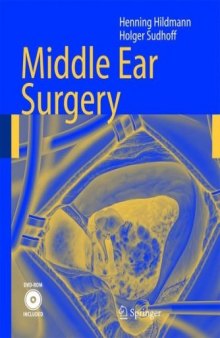 Middle ear surgery with 9 tables; [DVD-video included]