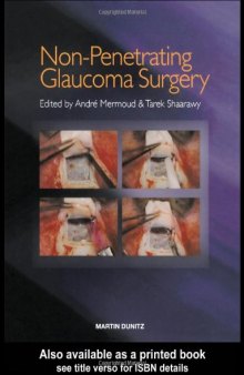 Non-Penetrating Glaucoma Surgery