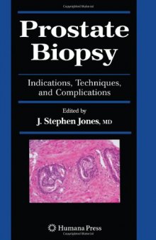 Prostate Biopsy: Indications, Techniques, and Complications