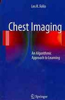 Chest Imaging: An Algorithmic Approach to Learning