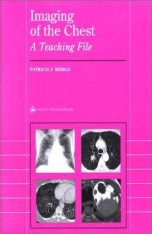 Imaging of the Chest: A Teaching File  