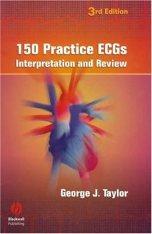 150 Practice ECGs: Interpretation and Review