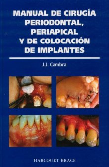 Manual De Cirugia Periodontal, Periapical Y De Colocacion De Implantes  Spanish