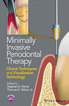 Minimally Invasive Periodontal Therapy: Clinical Techniques and Visualization Technology