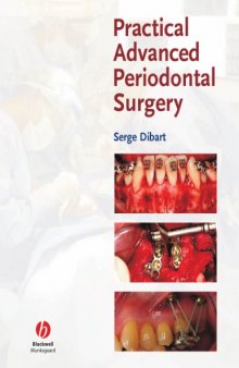 Practical Advanced Periodontal Surgery