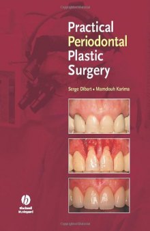 Practical Periodontal Plastic Surgery