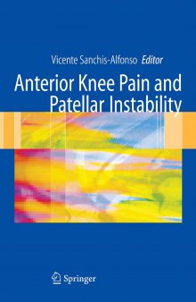 Anterior Knee Pain Patellar Instability