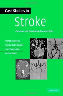 Case Studies in Stroke: Common and Uncommon Presentations (Case Studies in Neurology)