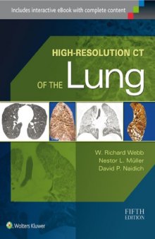 High Resolution CT of the Lung