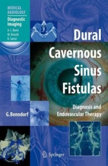 Dural Cavernous Sinus Fistulas: Diagnosis and Endovascular Therapy (Medical Radiology   Diagnostic Imaging)