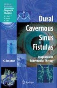 Dural Cavernous Sinus Fistulas: Diagnostic and Endovascular Therapy